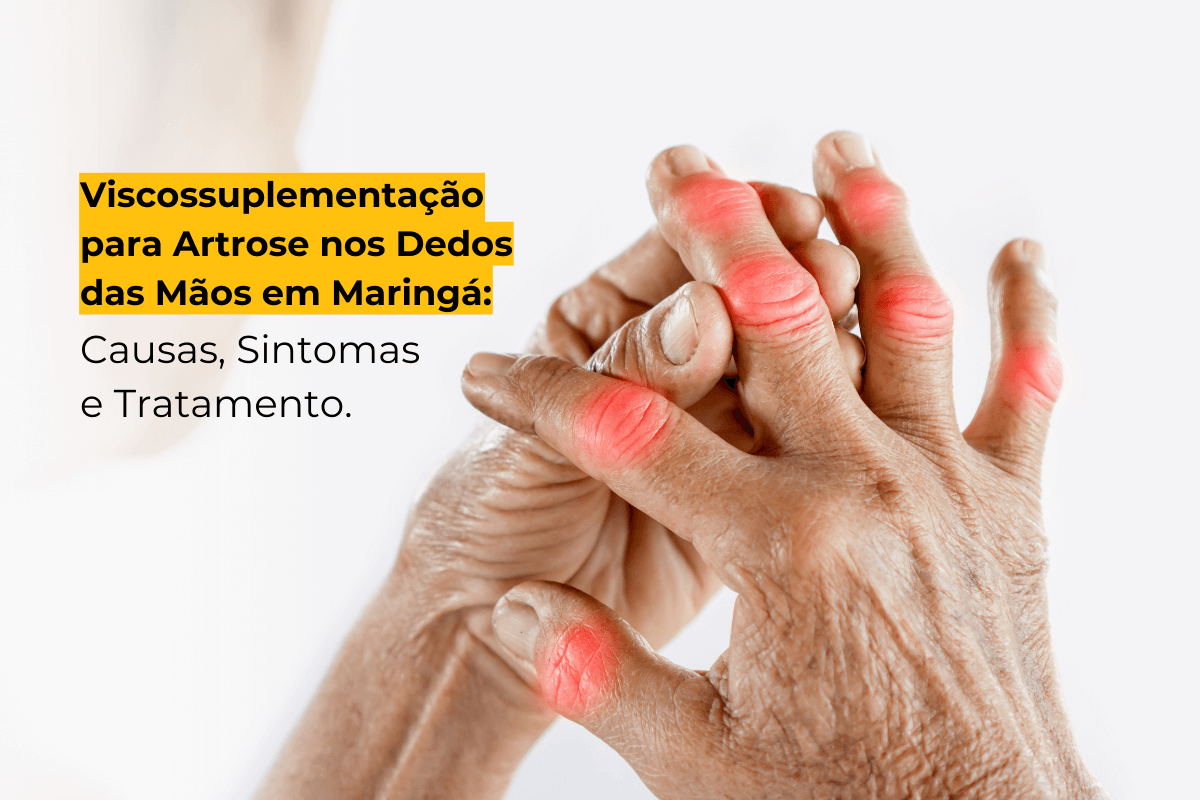 Viscossuplementação para Artrose nos Dedos das Mãos em Maringá: Causas, Sintomas e Tratamento.