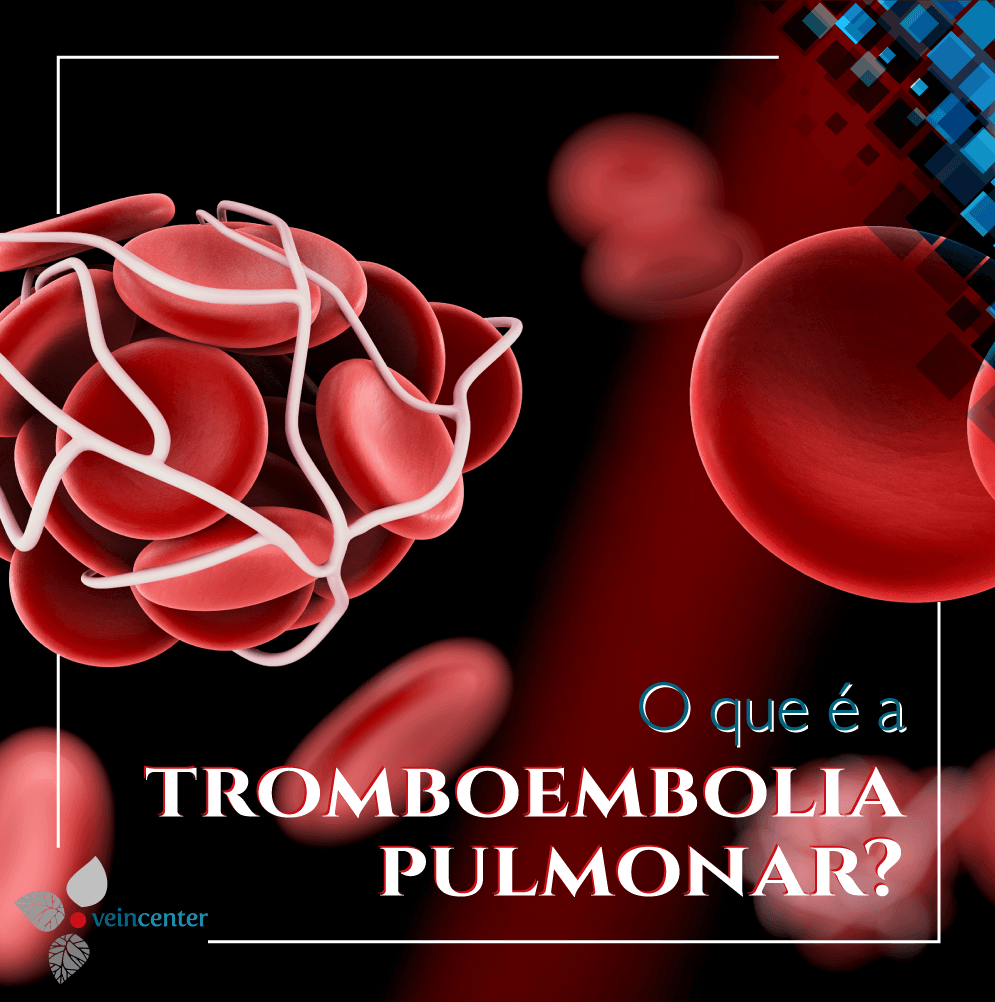 O que é a tromboembolia pulmonar