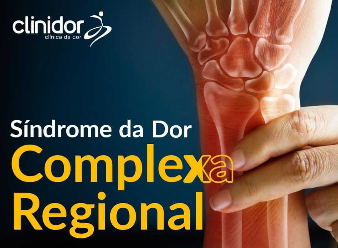 Síndrome da Dor Complexa Regional