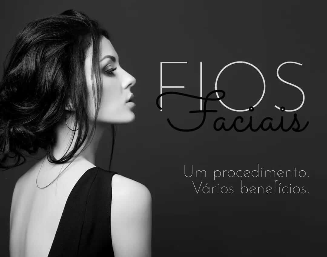 Fios faciais