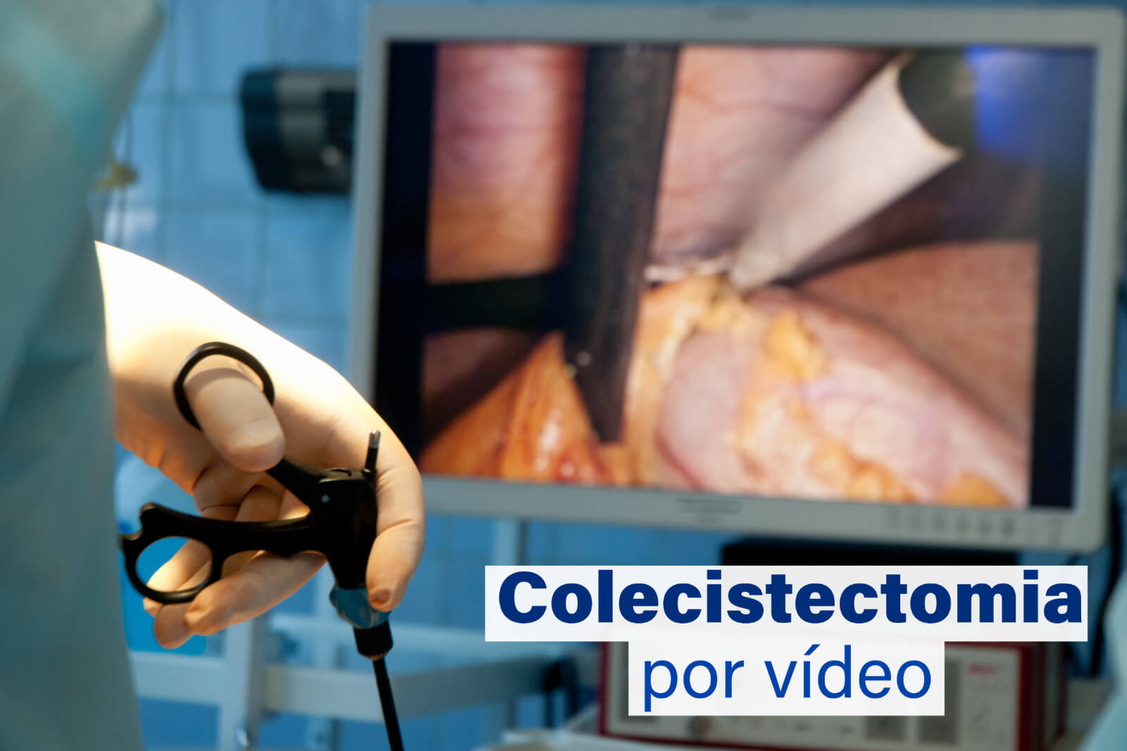 Colecistectomia por vídeo