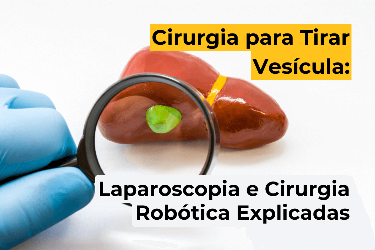 Cirurgia para Tirar Vesícula em Curitiba: Laparoscopia e Cirurgia Robótica Explicadas
