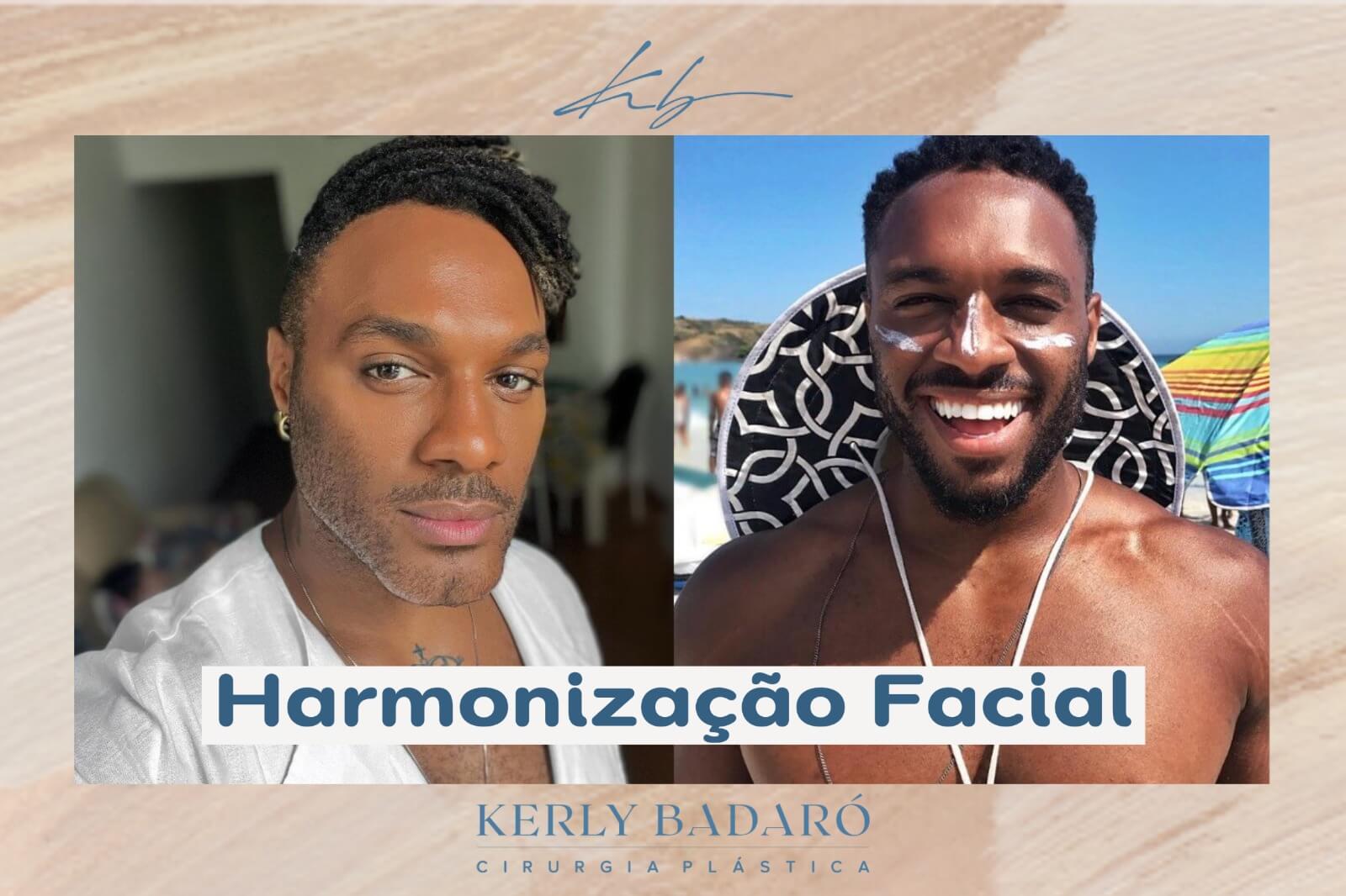 Harmonização Facial