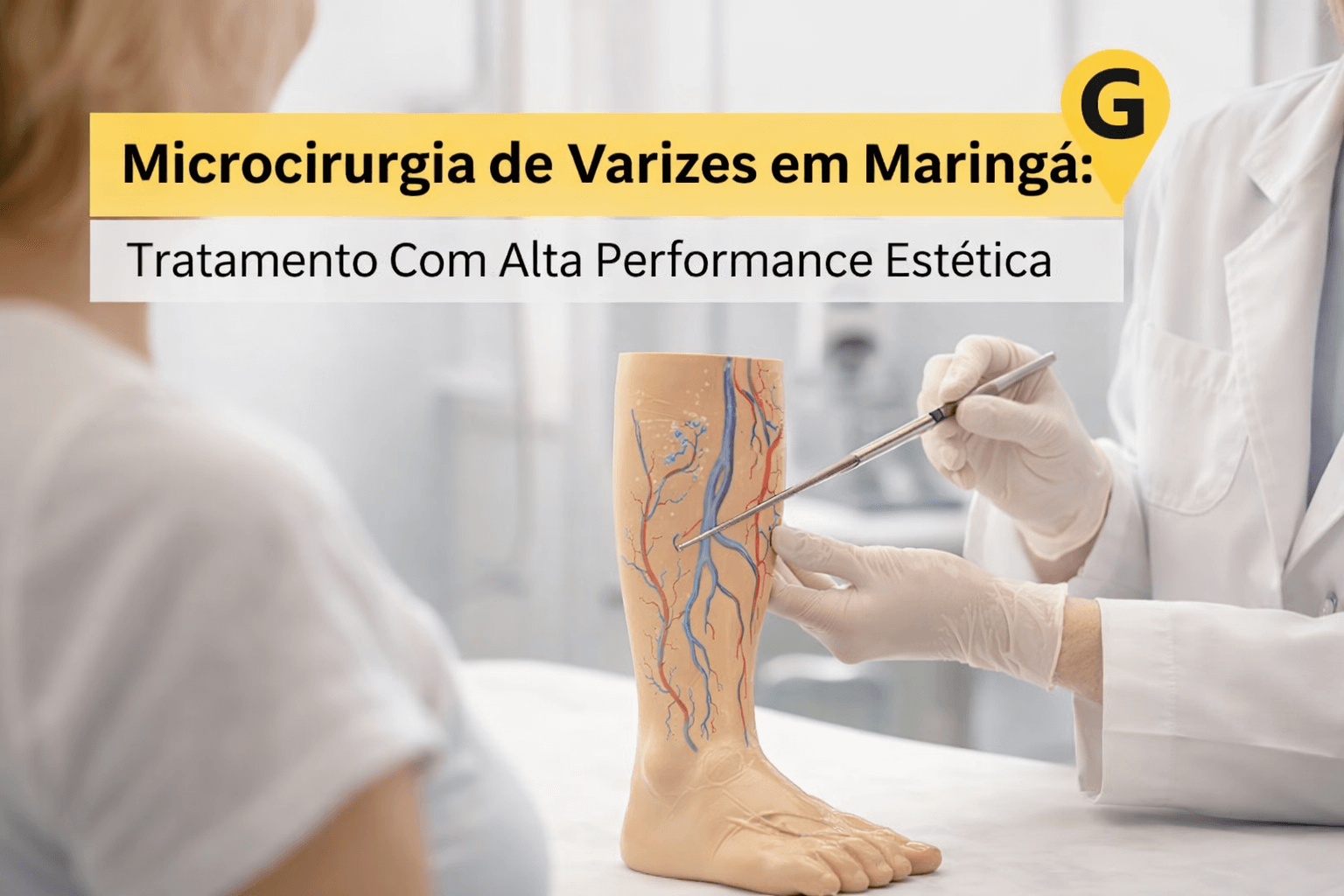 Microcirurgia de Varizes em Maringá: Tratamento Com Alta Performance Estética