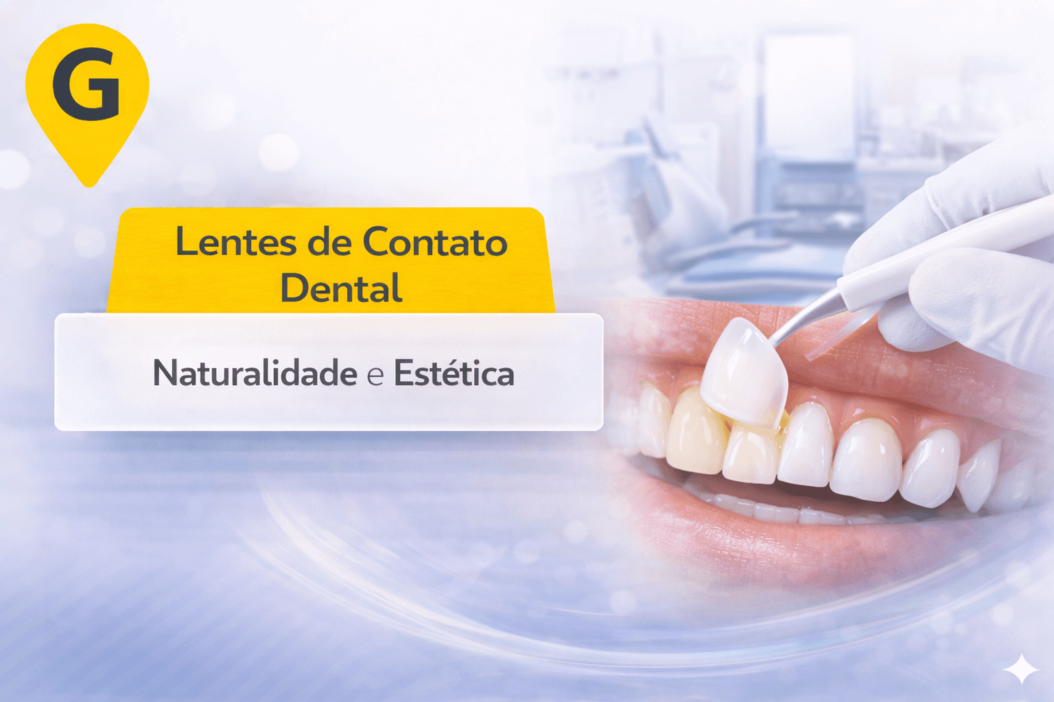 Lentes de Contato Dental em Maringá: Naturalidade e Estética