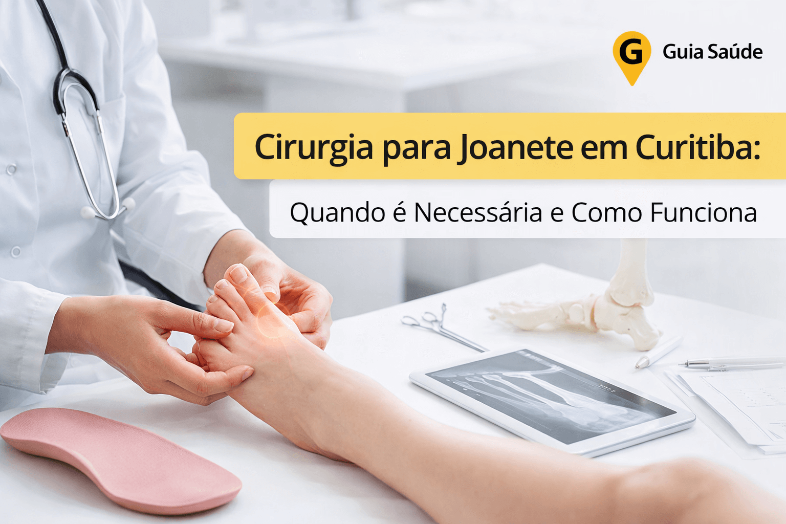 Cirurgia para Joanete em Curitiba: Quando é Necessária e Como Funciona
