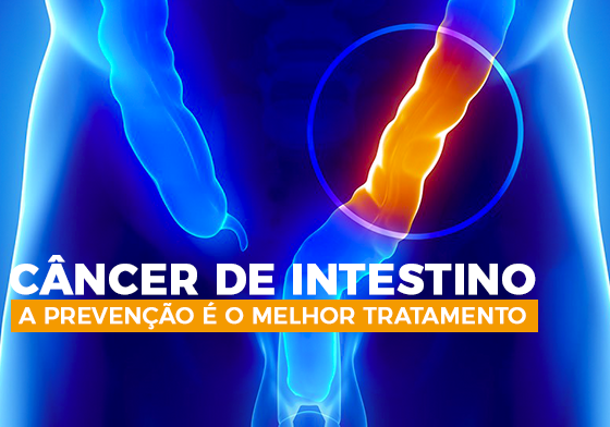 Câncer de intestino