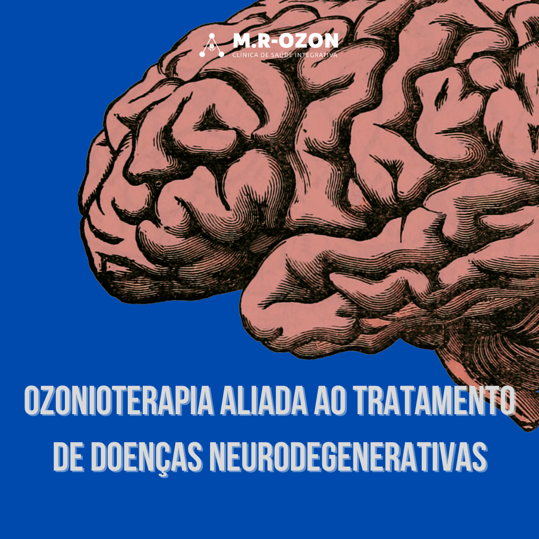 Ozonioterapia aliada ao tratamento de doenças neurodegenerativas. 