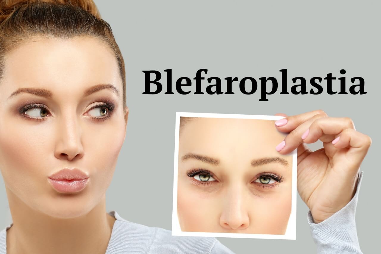 Blefaroplastia