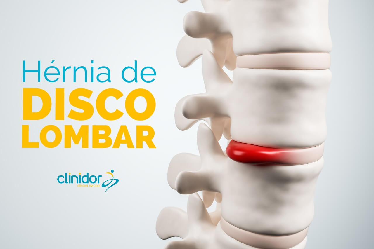 Hérnia de Disco lombar