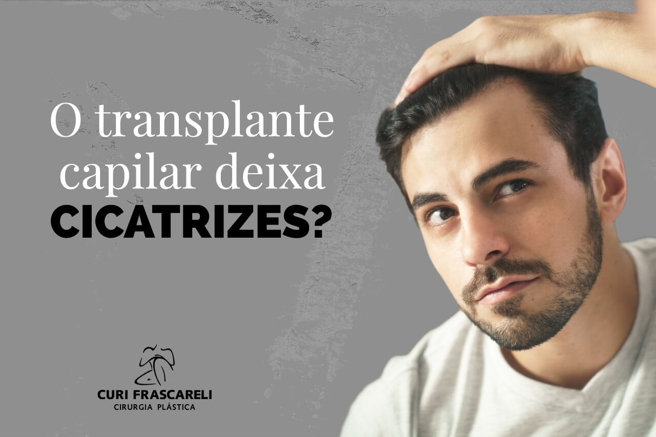 "O transplante capilar deixa cicatrizes? 