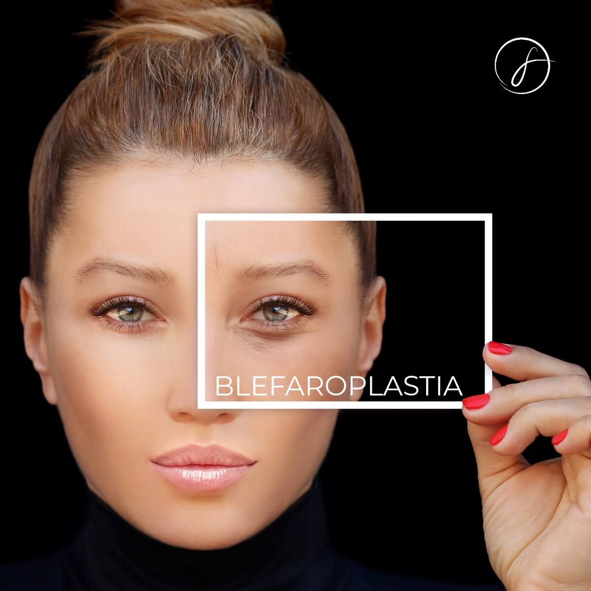 Blefaroplastia