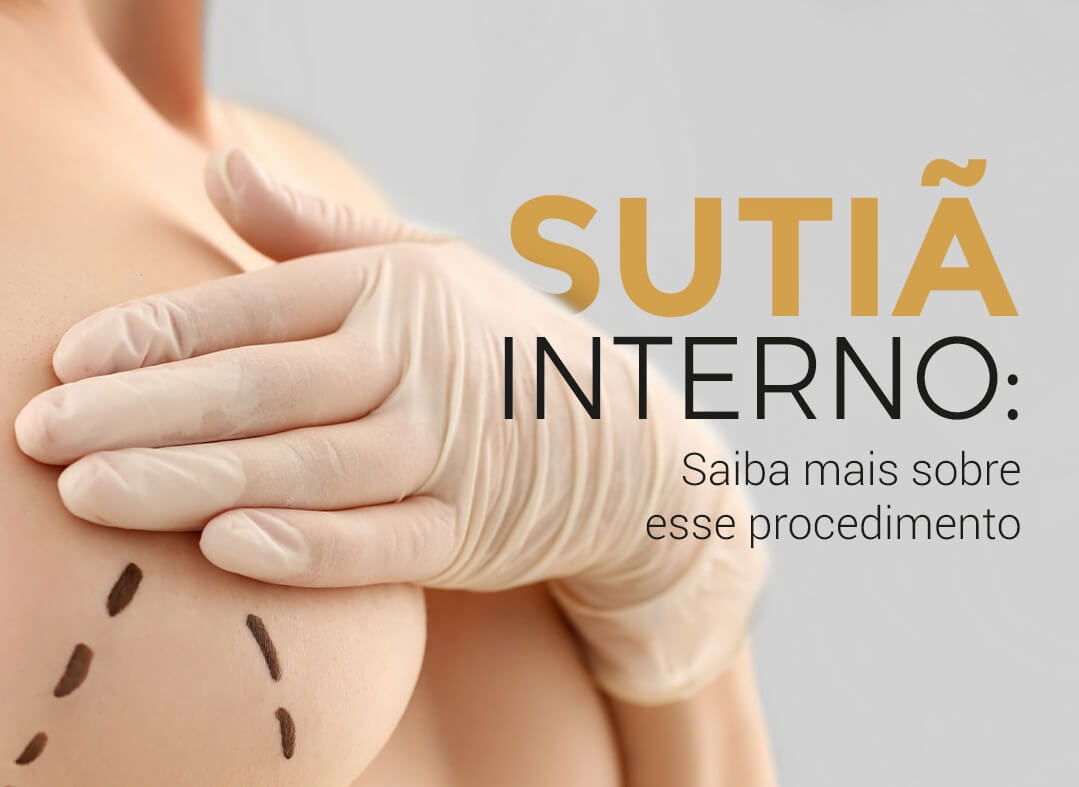 Sutiã interno: Saiba mais sobre esse procedimento