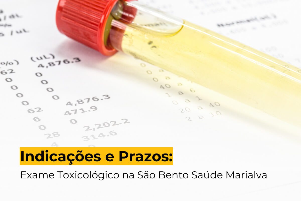 Indicações e Prazos: Exame Toxicológico na São Bento Saúde Marialva