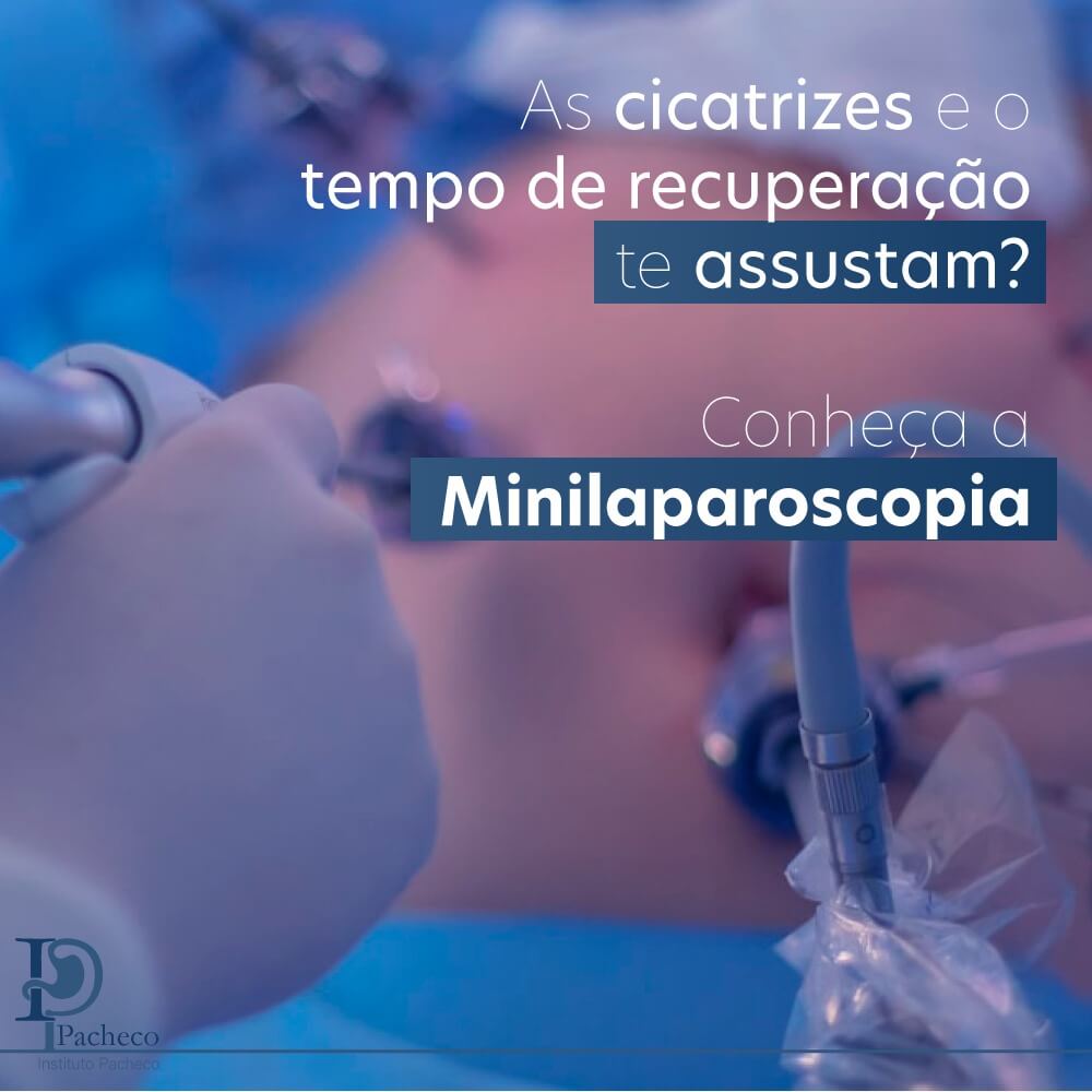 Minilaparoscopia