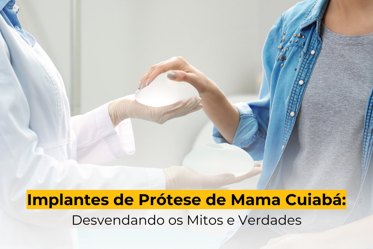 Implantes de Prótese de Mama Cuiabá: Desvendando os Mitos e Verdades