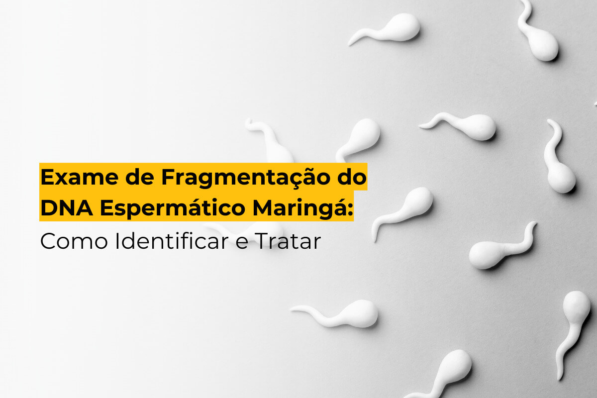 Exame de Fragmentação do DNA Espermático Maringá: Como Identificar e Tratar