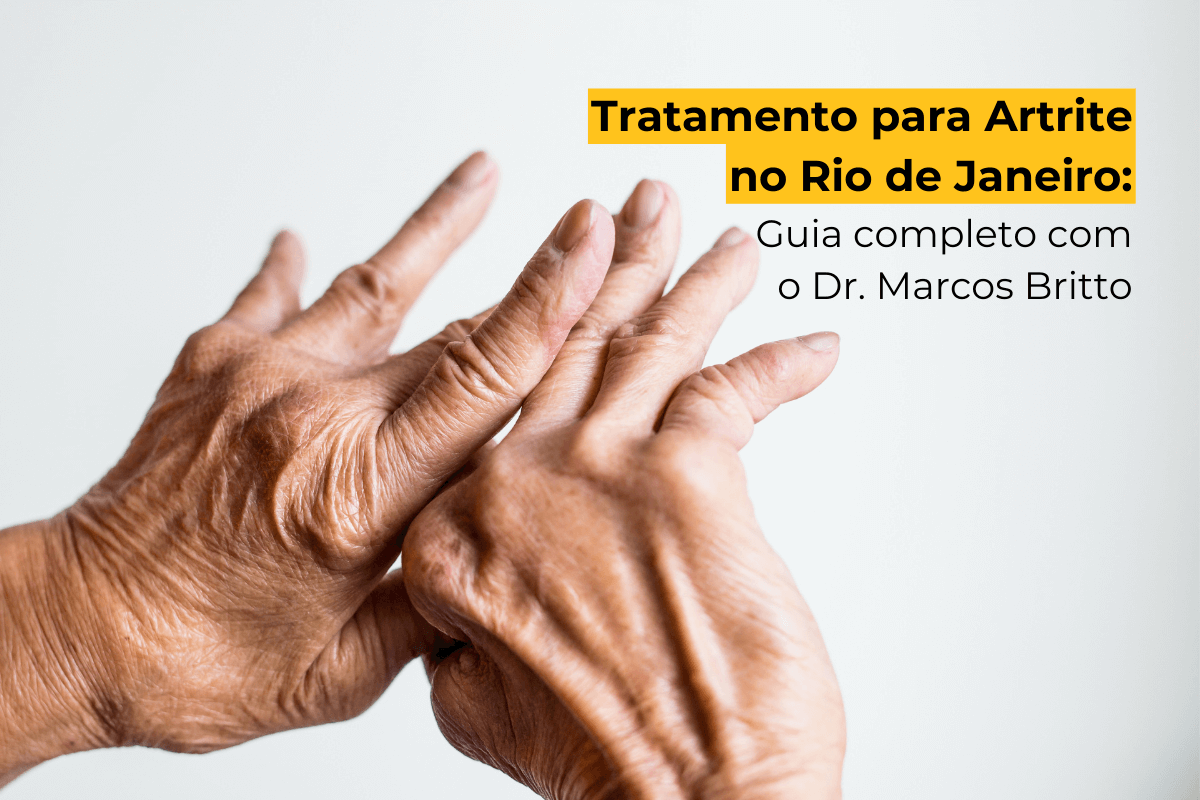 Tratamento para Artrite no Rio de Janeiro: Guia Completo com o Dr. Marcos Britto