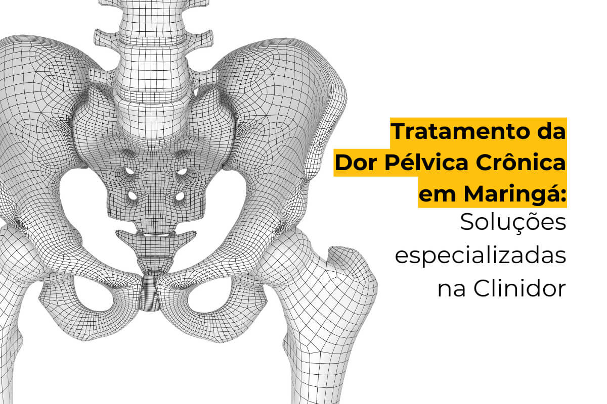 Tratamento da Dor Pélvica Crônica em Maringá: Soluções Especializadas na Clinidor