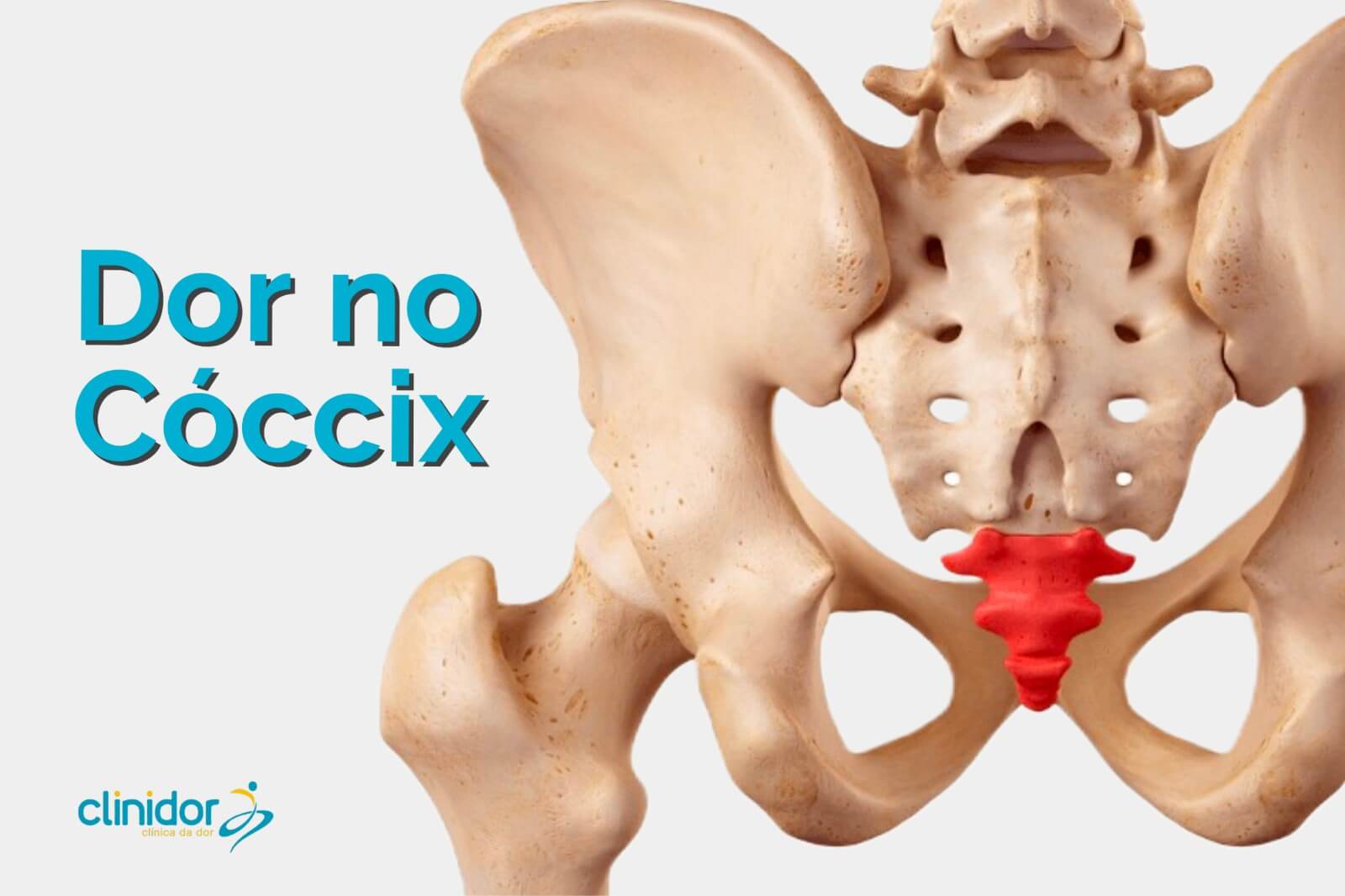Dor no Cóccix