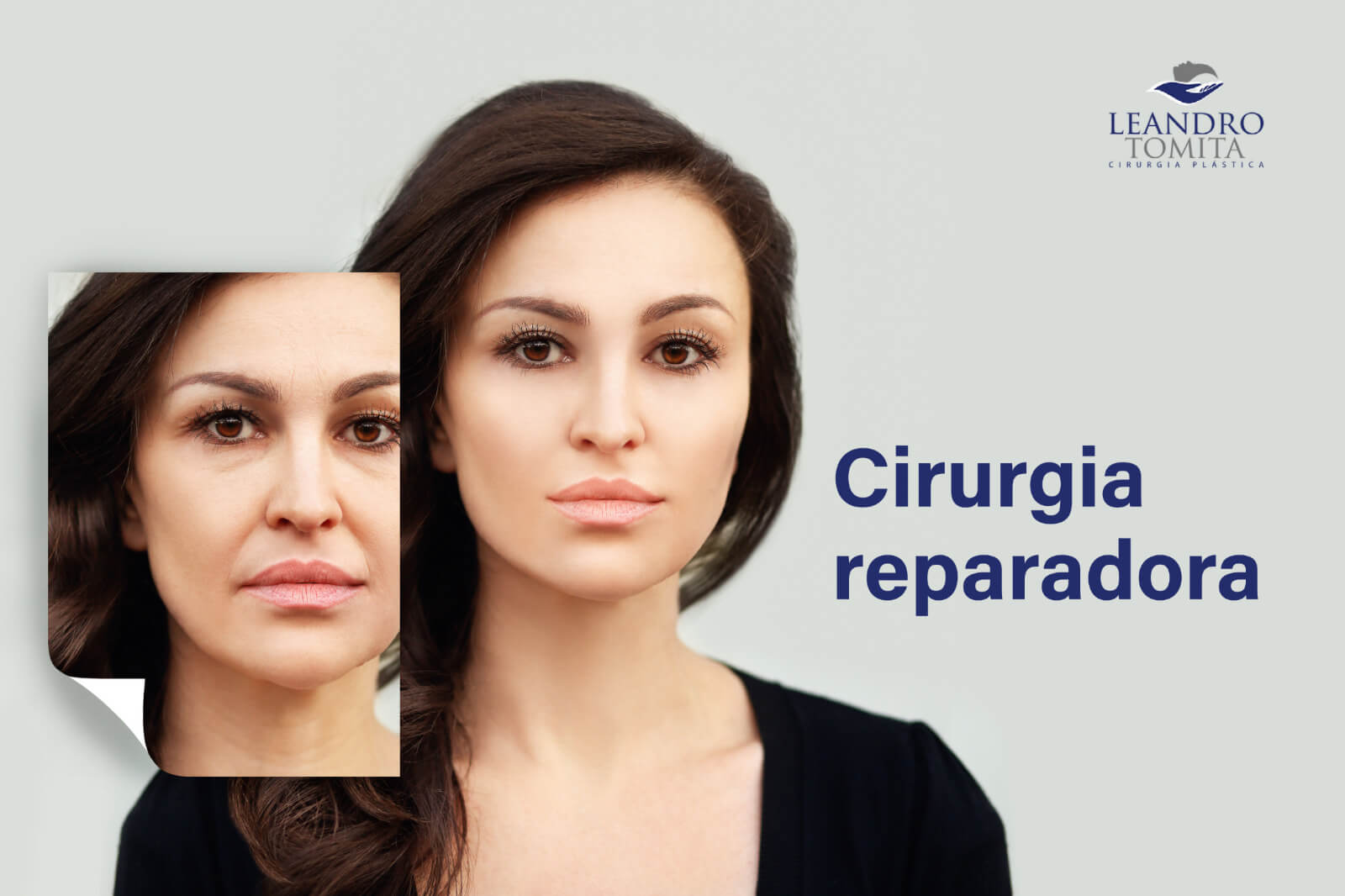 Cirurgia Plástica Reparadora