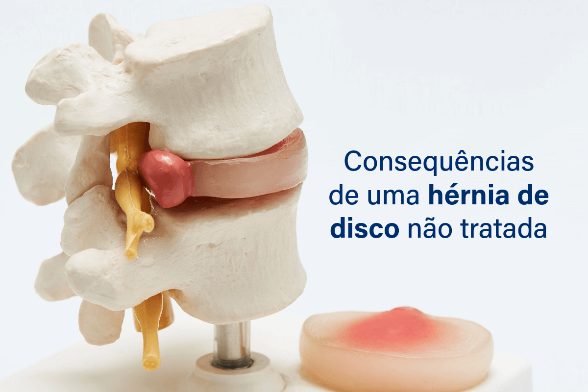 Consequências de uma hérnia de disco não tratada