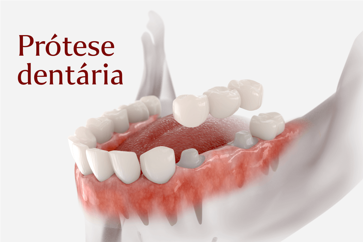 Prótese dentária