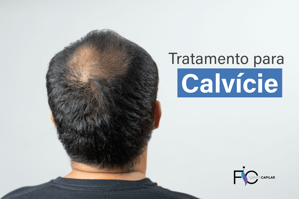 Tratamento para calvície