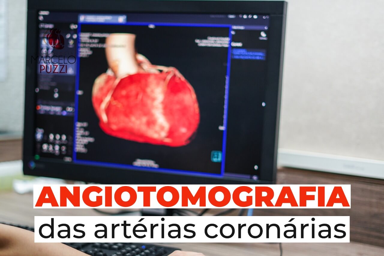  Angiotomografia das artérias coronárias
