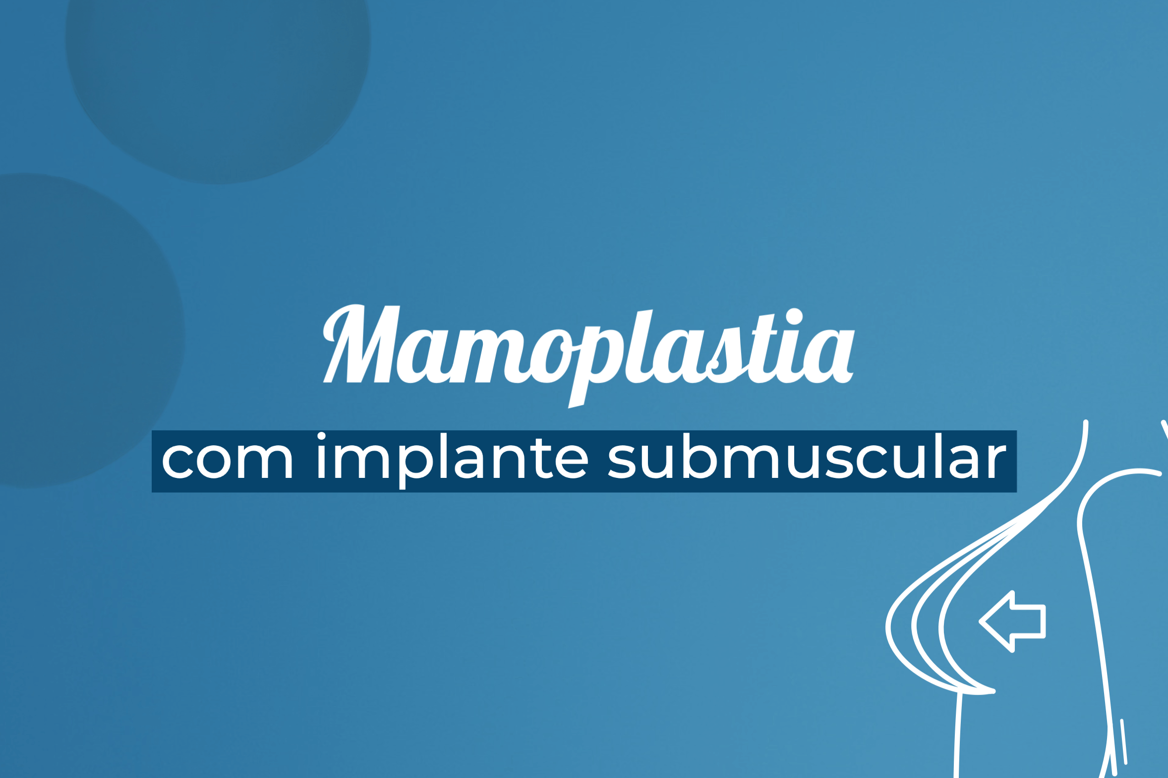 Mamoplastia com implante submuscular