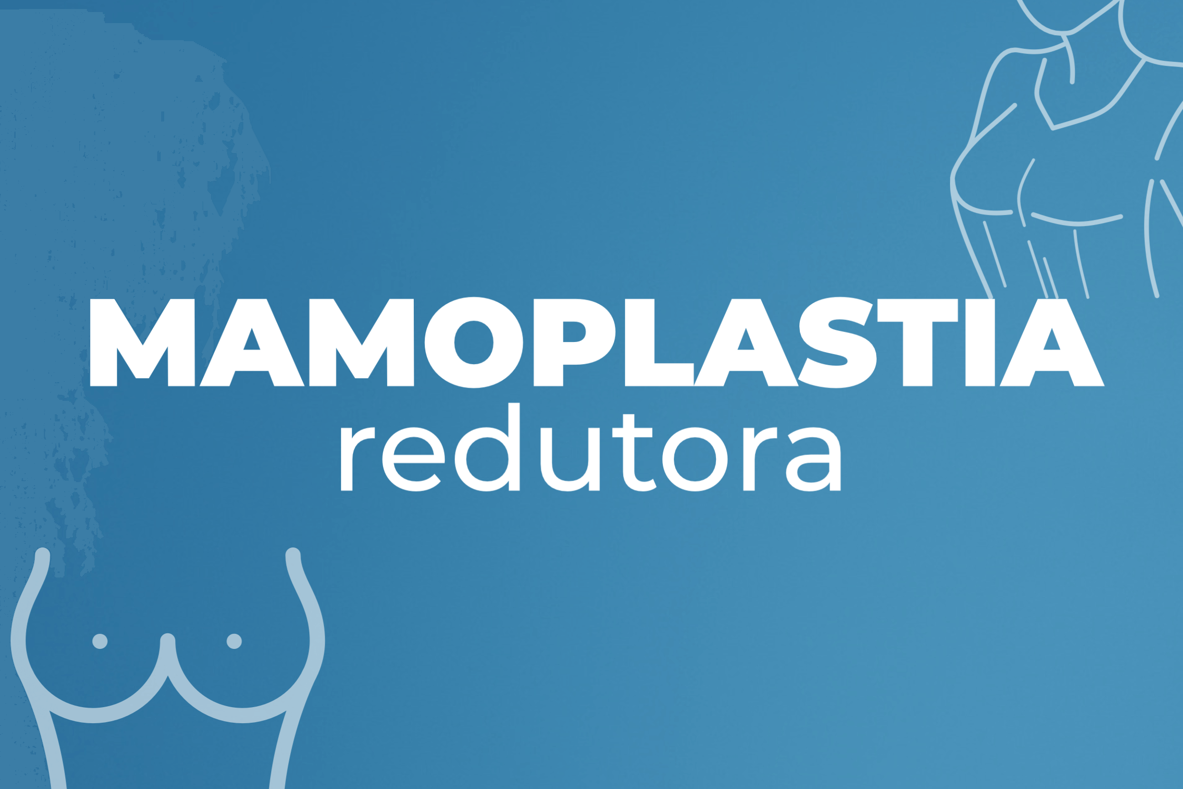 Mamoplastia redutora 