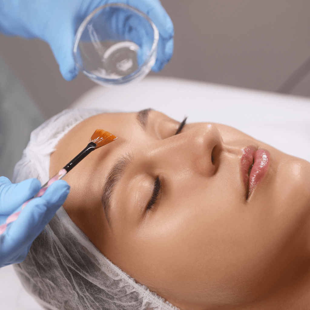 Peeling Químico em Guarujá: Benefícios do Procedimento para Pele