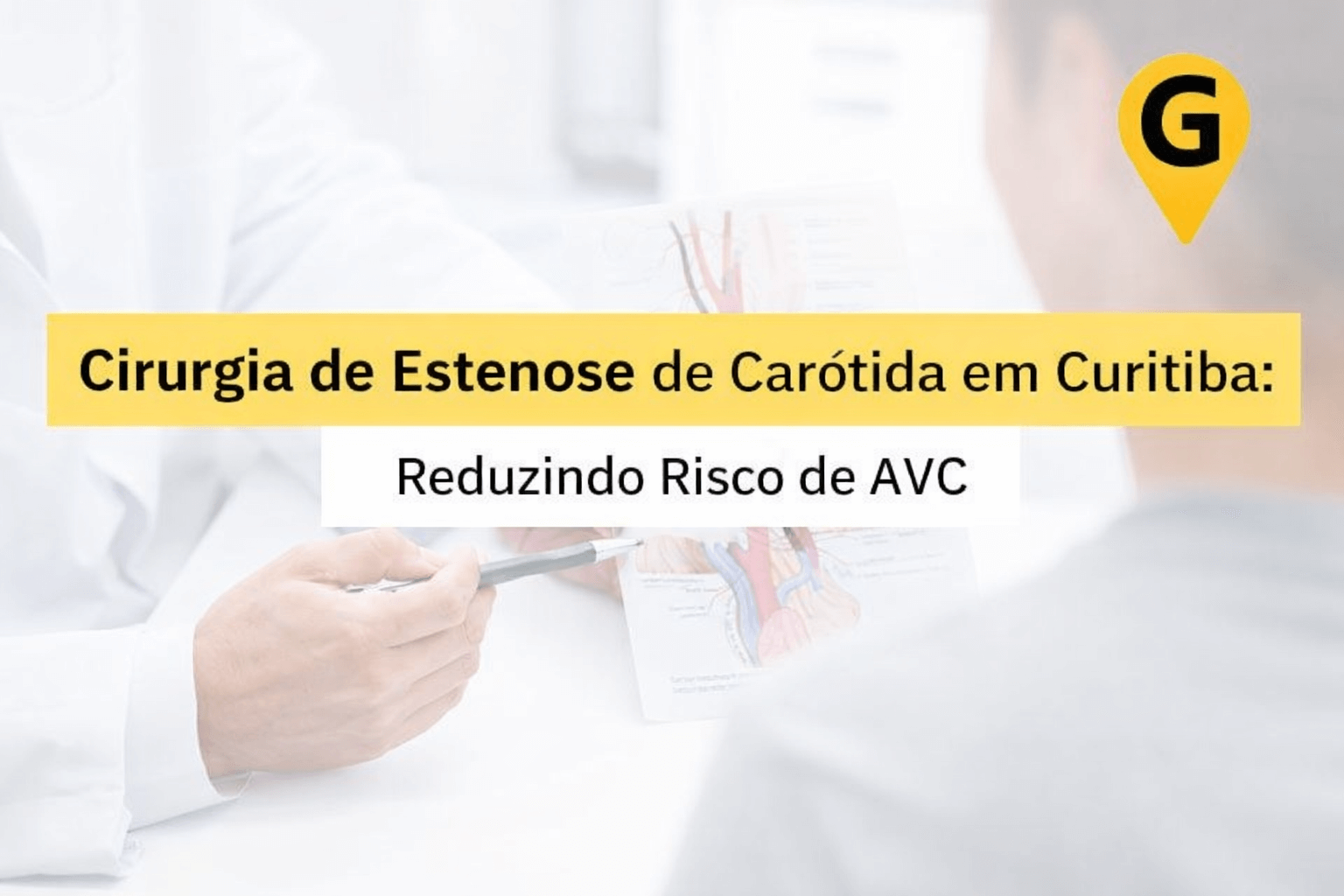 Cirurgia de Estenose de Carótida em Curitiba: Reduzindo Risco de AVC