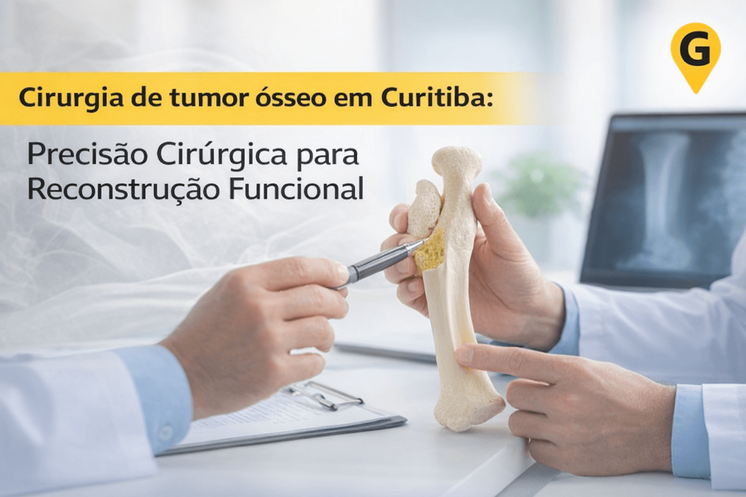 Cirurgia de tumor ósseo em Curitiba: Precisão Cirúrgica para Reconstrução Funcional