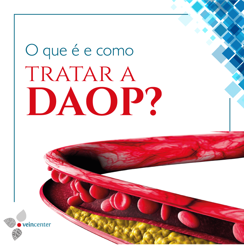 O que é e como tratar a DAOP?