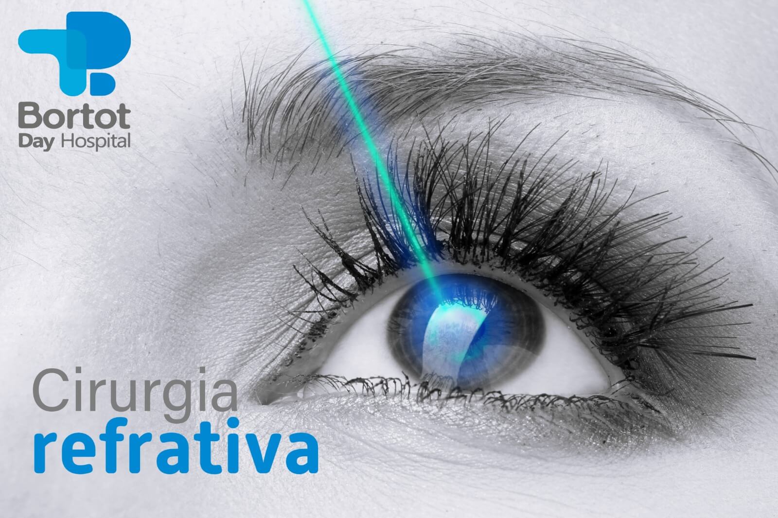 Cirurgia Refrativa