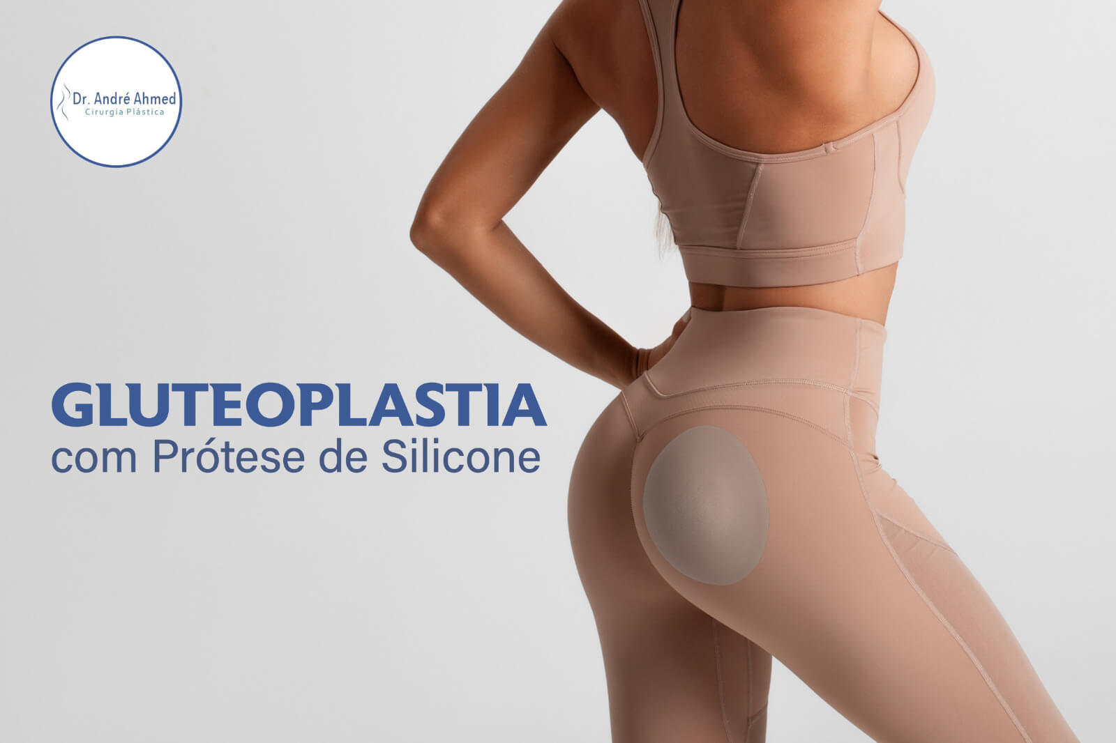 Gluteoplastia