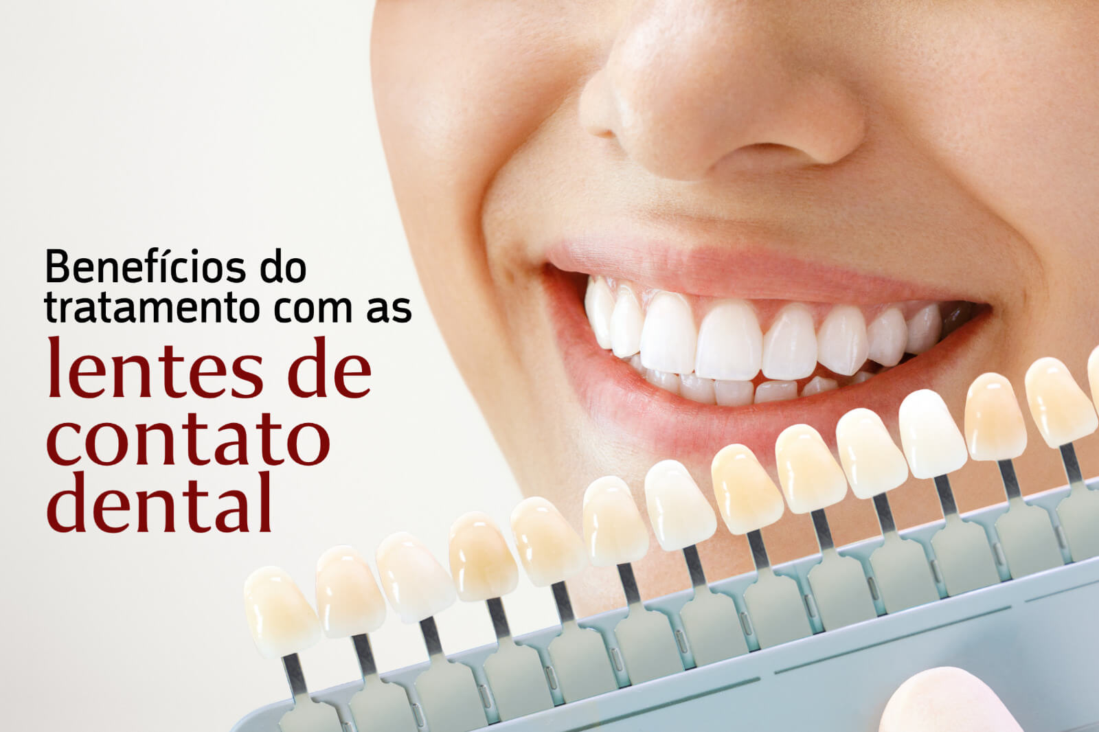 Lentes de Contato Dental