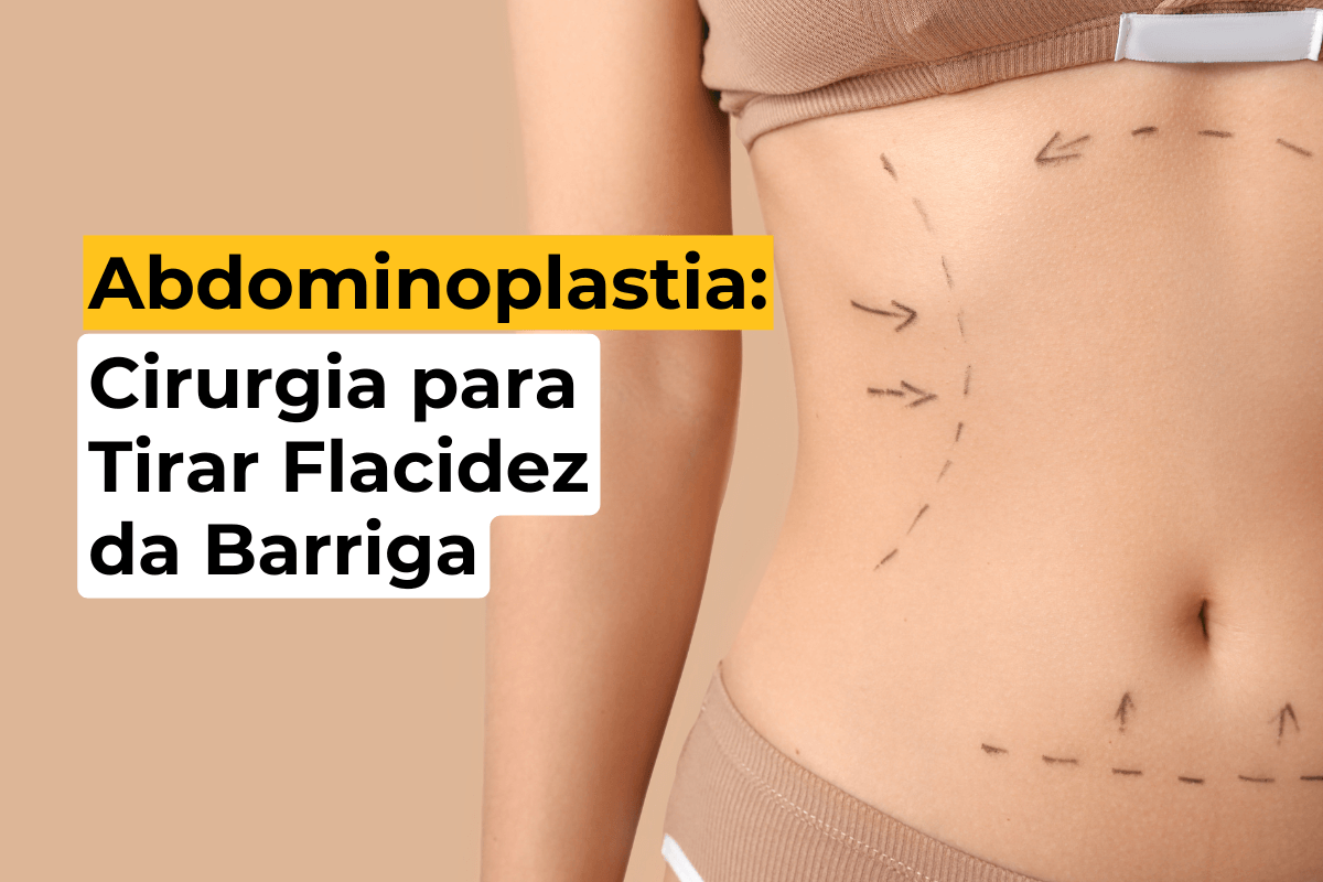 Abdominoplastia em Maringá: Cirurgia para Tirar Flacidez da Barriga