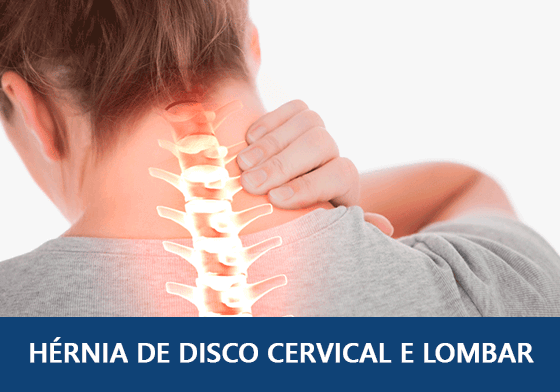 HÉRNIA DE DISCO CERVICAL E LOMBAR