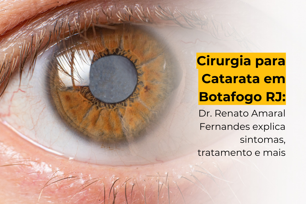 Cirurgia para Catarata em Botafogo RJ: Dr. Renato Amaral Fernandes Explica Sintomas, Tratamento e Mais
