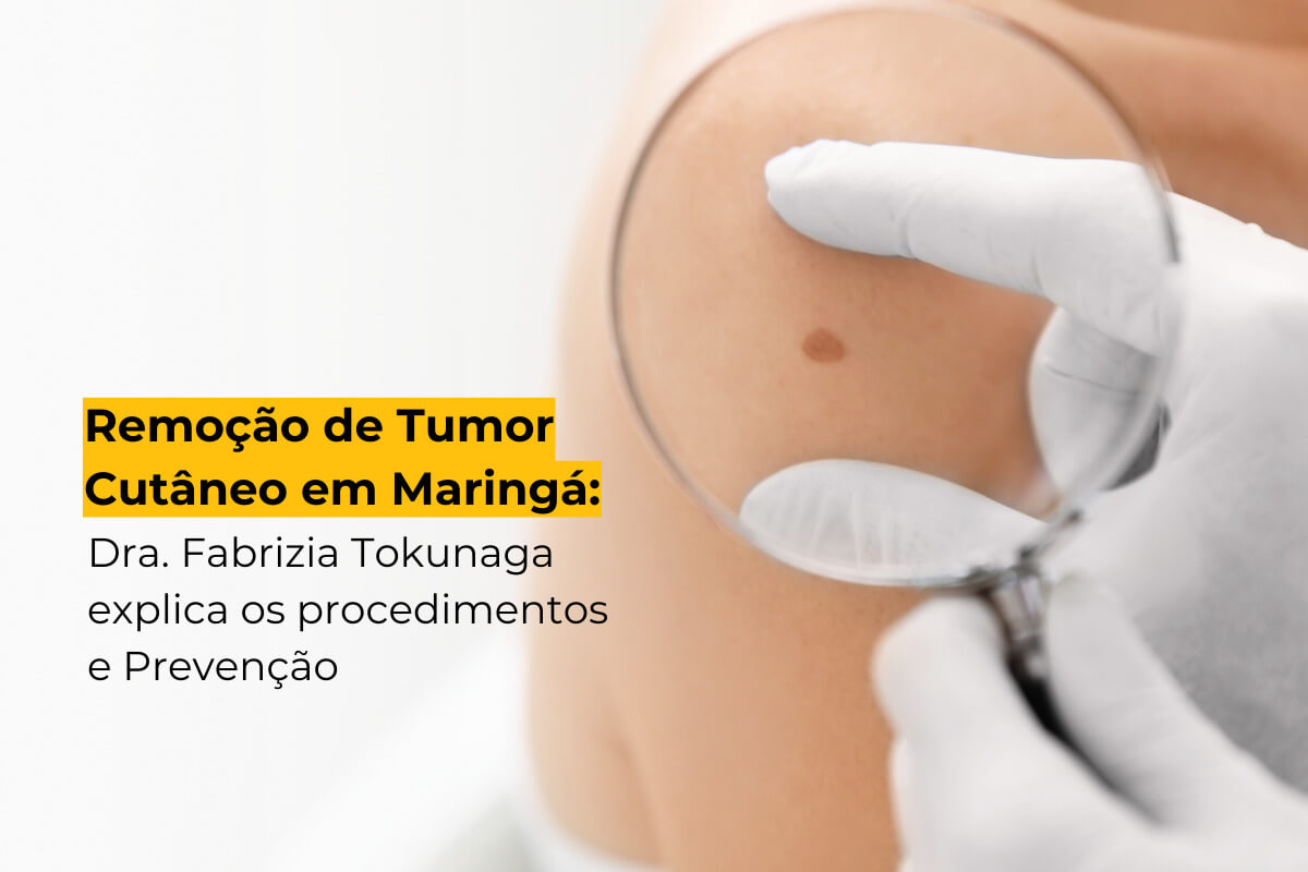 Remoção de Tumor Cutâneo em Maringá: Dra. Fabrizia Tokunaga Explica os Procedimentos e Prevenção