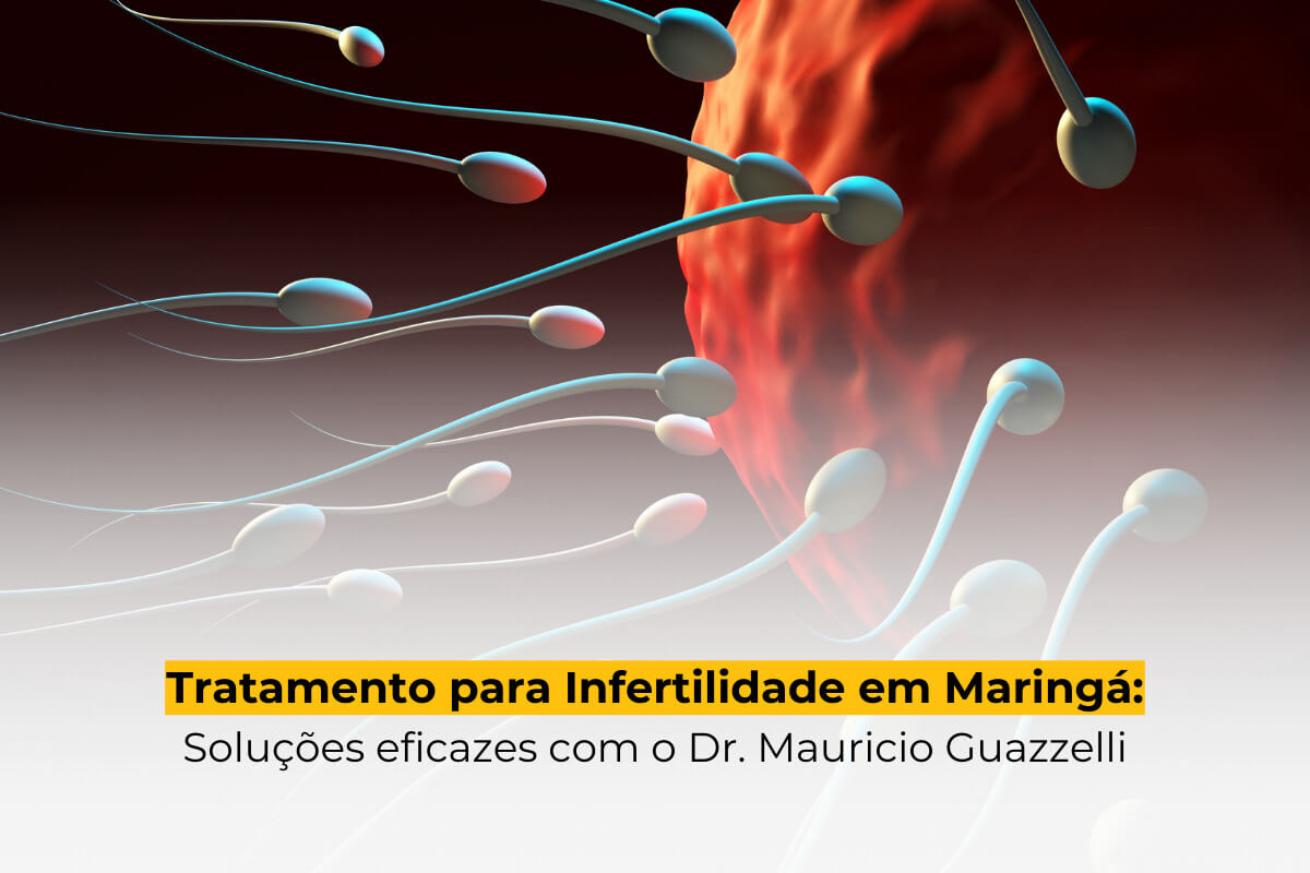 Tratamento para Infertilidade em Maringá: Soluções Eficazes com o Dr. Mauricio Guazzelli