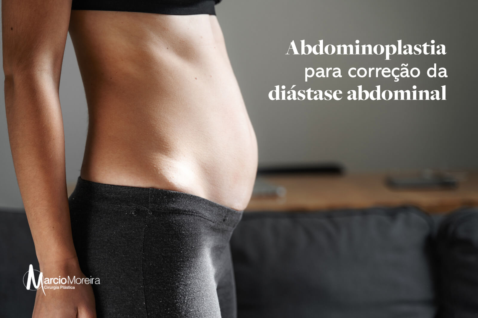 Abdominoplastia para correção da diástase abdominal