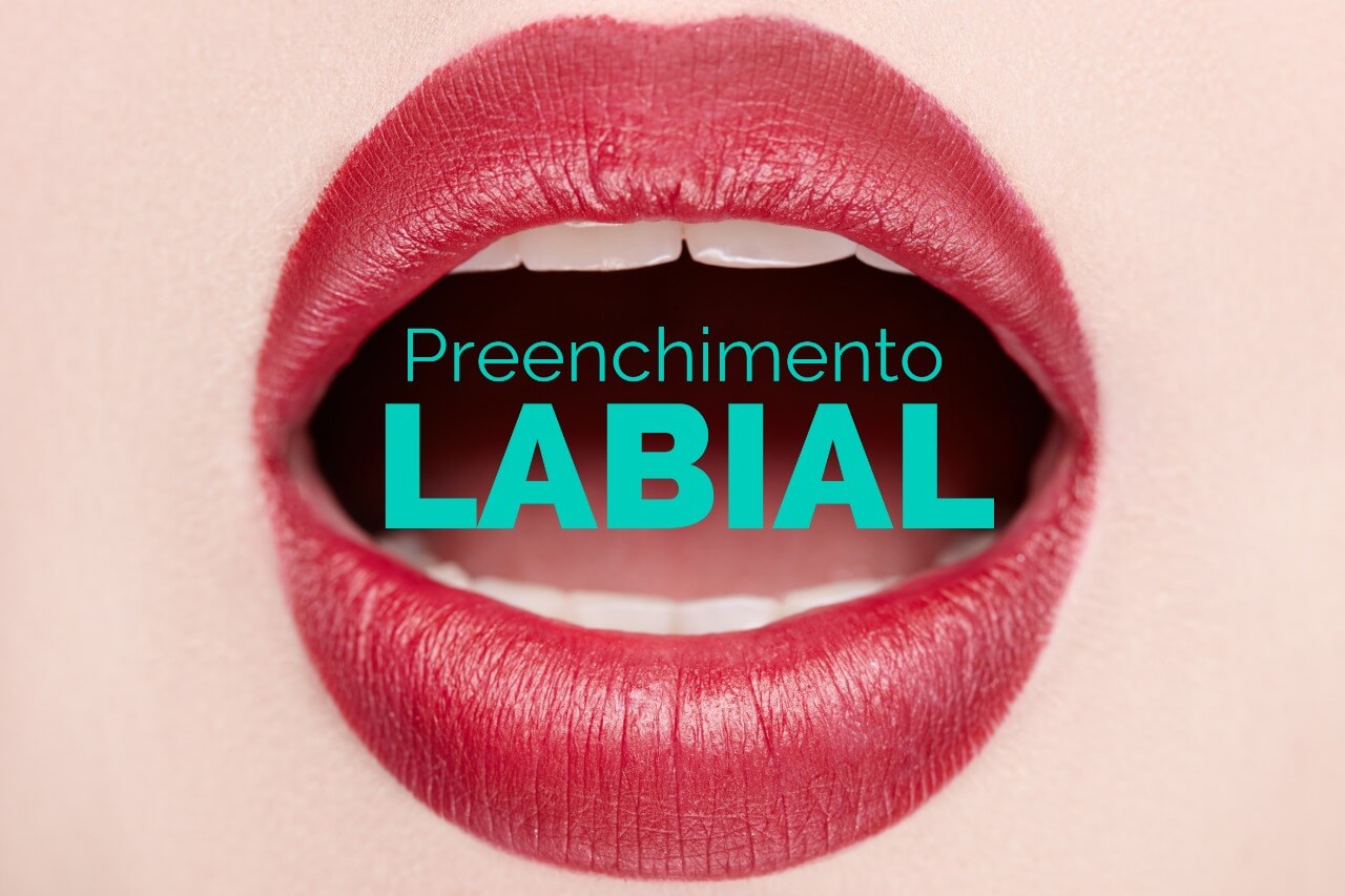 Preenchimento labial