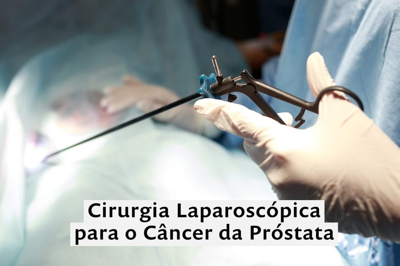 Cirurgia Laparoscópica para o Câncer da Próstata