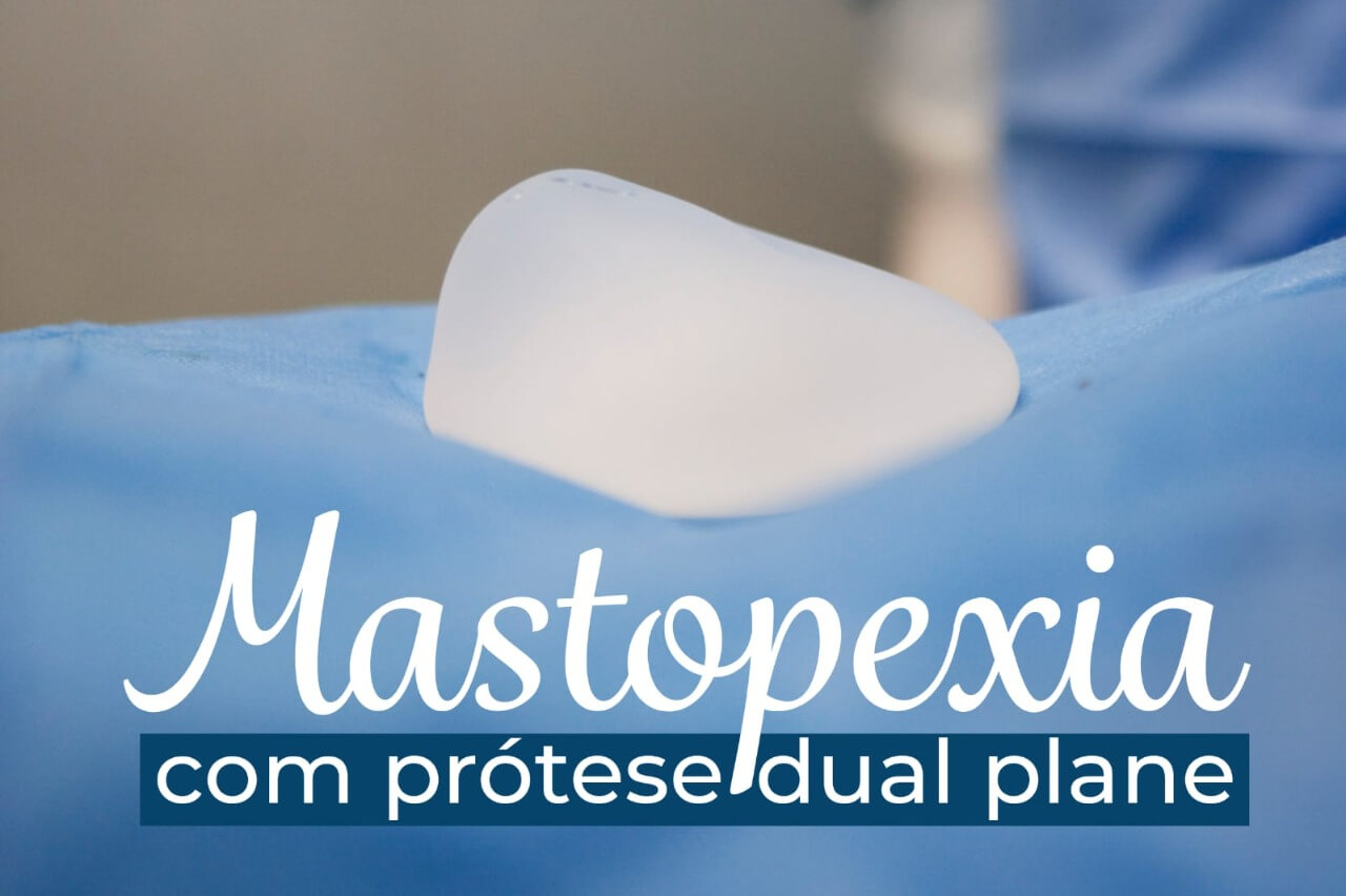 Mastopexia com prótese dual plane