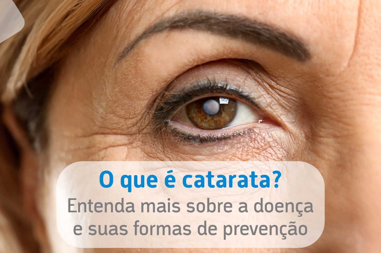 O que é catarata? Entenda mais sobre a doença e suas formas de prevenção