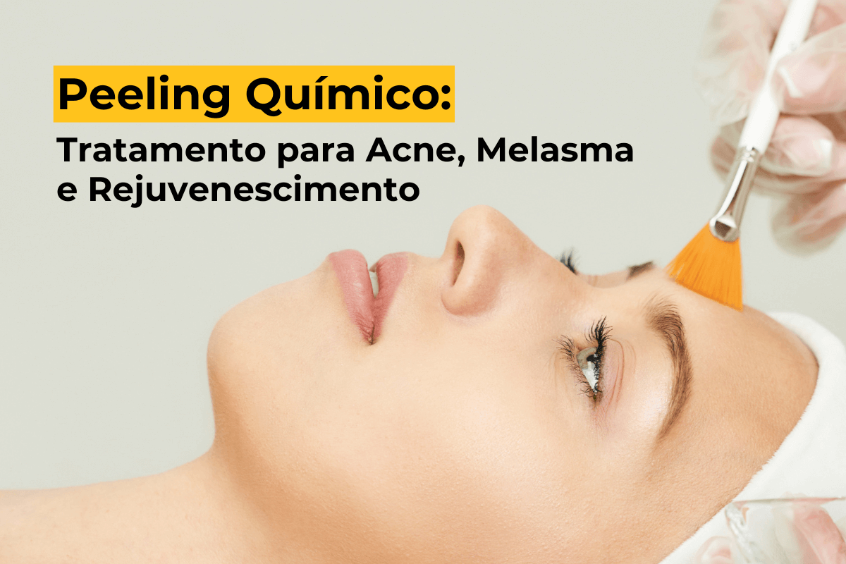 Peeling Químico em Maringá: Tratamento para Acne, Melasma e Rejuvenescimento