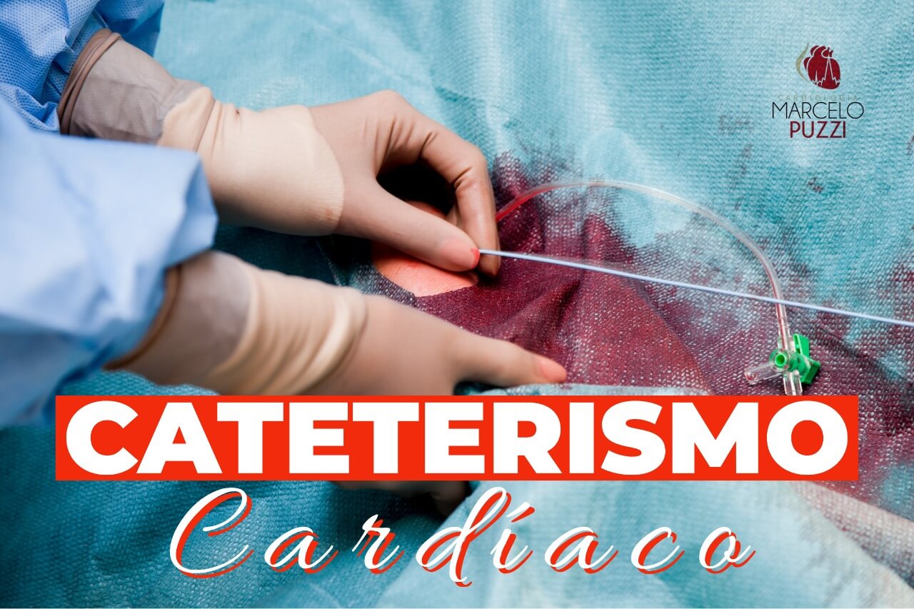 O que é e para que serve o Cateterismo cardíaco? 